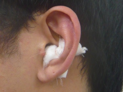 耳の固定
