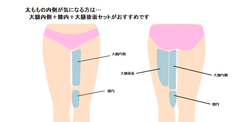 大腿内側の脂肪吸引