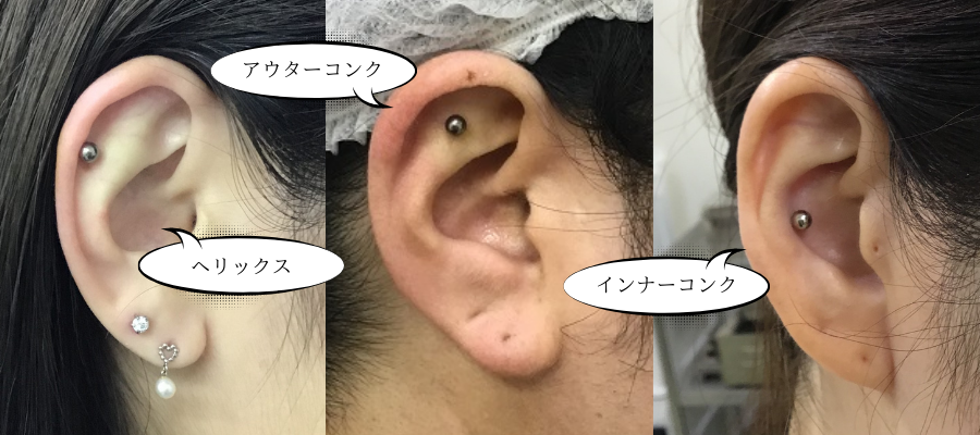 医療ピアス、ピアス穴あけなら | 浦和第一美容クリニック 