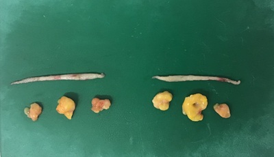 切除した皮膚および眼窩脂肪